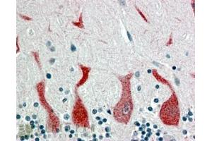 ABIN185366 (4µg/ml) staining of paraffin embedded Human Cerebellum. (Retinoic Acid Receptor alpha antibody  (C-Term))