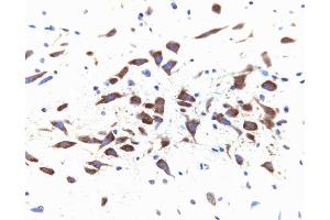Immunohistochemical staining for Dynamin II on a rat brain section, zinc-fixed paraffin-embedded (40X magnification). (DNM2 antibody  (AA 274-555))