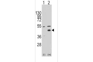 Western blot analysis of WIF1 (arrow) using rabbit polyclonal WIF1 Antibody (N-term) (ABIN389184 and ABIN2839347). (WIF1 antibody  (N-Term))