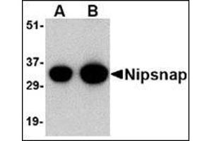 Western blot analysis of NIPSNAP in human brain tissue lysate with this product at (A) 0.