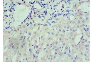 Immunohistochemistry of paraffin-embedded human liver tissue using ABIN7161434 at dilution of 1:100 (Neuropilin 1 antibody  (AA 684-923))