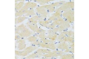 Immunohistochemistry of paraffin-embedded mouse heart using CXCR3 Antibody. (CXCR3 antibody)