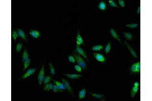 Immunofluorescent analysis of Hela cells using ABIN7154903 at dilution of 1:100 and Alexa Fluor 488-congugated AffiniPure Goat Anti-Rabbit IgG(H+L) (TRAP1 antibody  (AA 60-308))