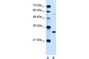 WB Suggested Anti-HFE Antibody Titration:  0.
