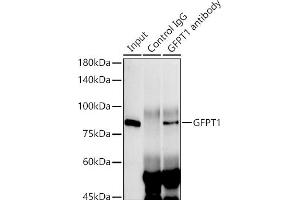 Immunoprecipitation analysis of 300 μg extracts of HeLa cells using 3 μg GFPT1 antibody (ABIN7267430). (GFPT1 antibody)