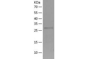 Western Blotting (WB) image for Tetratricopeptide Repeat Domain 33 (TTC33) (AA 1-262) protein (His tag) (ABIN7287669) (TTC33 Protein (AA 1-262) (His tag))