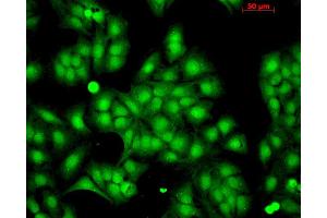 Immunocytochemistry/Immunofluorescence analysis using Rabbit Anti-HSP22 Polyclonal Antibody . (HSPB8 antibody  (Biotin))