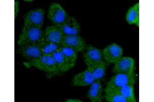 MCF-7 cells were stained with Cytokeratin 13 (5A3) Monoclonal Antibody  at [1:200] incubated overnight at 4C, followed by secondary antibody incubation, DAPI staining of the nuclei and detection.