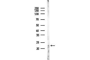 anti-Interleukin 23, alpha subunit p19 (IL23A) antibody