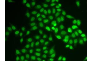 Immunofluorescence (IF) image for anti-Ubiquitin-Conjugating Enzyme E2 Variant 1 (UBE2V1) antibody (ABIN1980332) (UBE2V1 antibody)