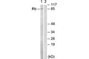 Western blot analysis of extracts from HeLa cells, treated with Calyculin A 50nM 30', using Retinoblastoma (Ab-811) Antibody. (Retinoblastoma Protein (Rb) antibody  (AA 771-820))