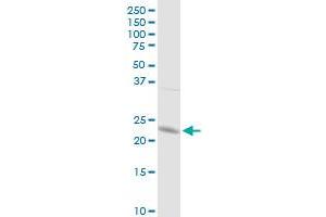 GSTP1 MaxPab rabbit polyclonal antibody. (GSTP1 antibody  (AA 1-210))