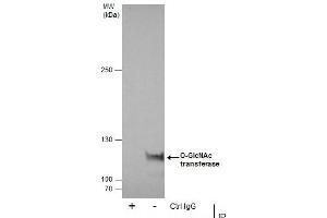 IP Image Immunoprecipitation of O-GlcNAc transferase protein from A431 whole cell extracts using 5 μg of O-GlcNAc transferase antibody, Western blot analysis was performed using O-GlcNAc transferase antibody, EasyBlot anti-Rabbit IgG  was used as a secondary reagent.