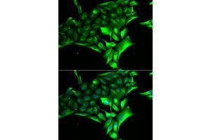 Immunofluorescence analysis of MCF-7 cell using PYGB antibody. (PYGB antibody)