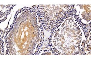 Immunohistochemistry (IHC) image for anti-Hypoxia Inducible Factor 1, alpha Subunit (Basic Helix-Loop-Helix Transcription Factor) (HIF1A) (AA 216-336) antibody (ABIN7432643)