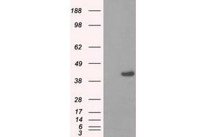 HEK293T cells were transfected with the pCMV6-ENTRY control (Left lane) or pCMV6-ENTRY PPME1 (Right lane) cDNA for 48 hrs and lysed. (PPME1 antibody)