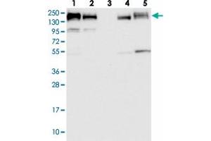 Western blot analysis of Lane 1: RT-4, Lane 2: U-251 MG, Lane 3: Human Plasma, Lane 4: Liver, Lane 5: Tonsil with GOLGA3 polyclonal antibody  at 1:100-1:250 dilution. (Golgin A3 antibody)