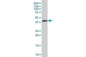 PDK2 polyclonal antibody (A01), Lot # 051011JC01 Western Blot analysis of PDK2 expression in SJCRH30 . (PDK2 antibody  (AA 187-276))