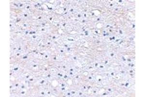 Immunohistochemical staining of human brain tissue using HAPLN2 polyclonal antibody  at 2. (HAPLN2 antibody  (Internal Region))