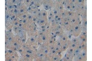 Detection of TOR1B in Human Liver Tissue using Polyclonal Antibody to Torsin 1B (TOR1B) (TOR1B antibody  (AA 98-327))