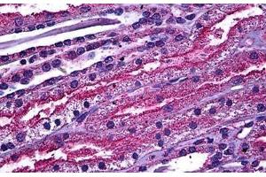 Human Kidney: Formalin-Fixed, Paraffin-Embedded (FFPE) (ABCC4 antibody  (AA 1-110))