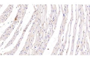 Detection of ADPN in Rat Heart Tissue using Monoclonal Antibody to Adiponectin (ADPN) (ADIPOQ antibody  (AA 111-244))