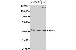 Western blot analysis of extracts of various cell lines, using BMP2 Antibody. (BMP2 antibody  (AA 283-396))