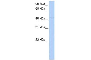 PECI antibody used at 1 ug/ml to detect target protein. (PECI/ECI2 antibody  (Middle Region))