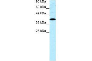 WB Suggested Anti-NR4A1 Antibody Titration:  0. (NR4A1 antibody  (N-Term))