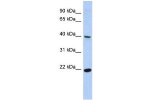 WB Suggested Anti-SSBP4 Antibody Titration:  0. (SSBP4 antibody  (Middle Region))