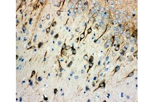 IHC-P: AChR antibody testing of rat brain tissue (CHRM1 antibody  (AA 303-317))