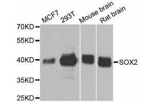 Western blot analysis of extracts of various cell lines, using SOX2 antibody. (SOX2 antibody)