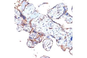 Immunohistochemistry of paraffin-embedded human placenta using ER Rabbit mAb (ABIN7266941) at dilution of 1:100 (40x lens). (ERAP1 antibody)