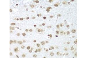 Immunohistochemistry of paraffin-embedded Mouse brain using SAP18 Polyclonal Antibody at dilution of 1:100 (40x lens). (SAP18 antibody)