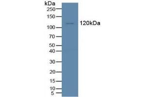 Figure. (TIE1 antibody  (AA 435-609))