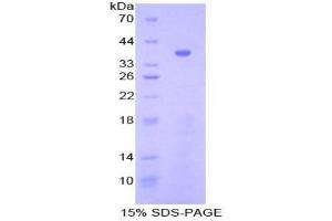 gamma Lipotropin protein