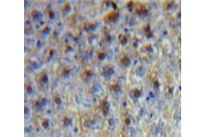 Used in DAB staining on fromalin fixed paraffin-embedded Liver tissue (CEBPG antibody  (AA 1-150))