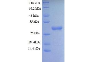 SDS-PAGE (SDS) image for SWI/SNF Related, Matrix Associated, Actin Dependent Regulator of Chromatin, Subfamily C, Member 1 (SMARCC1) (AA 449-669) protein (His tag) (ABIN4986572)