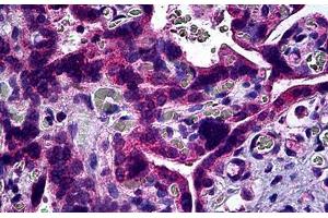 Human Placenta: Formalin-Fixed, Paraffin-Embedded (FFPE) (S1PR3 antibody)