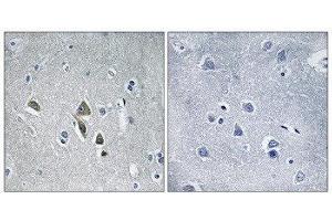 Immunohistochemistry (IHC) image for anti-Ornithine Decarboxylase Antizyme 1 (OAZ1) (N-Term) antibody (ABIN1851760) (OAZ1 antibody  (N-Term))