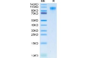 HAVCR1 Protein (AA 21-295) (His tag)