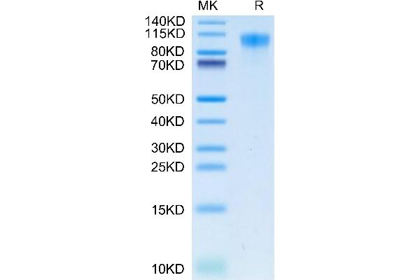 HAVCR1 Protein (AA 21-295) (His tag)