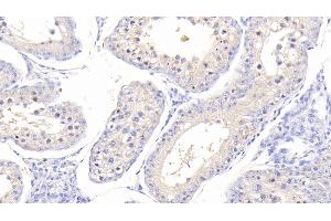 Detection of H-FABP in Bovine Testis Tissue using Polyclonal Antibody to Heart-type Fatty Acid Binding Protein (H-FABP)