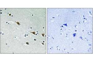 Immunohistochemistry analysis of paraffin-embedded human brain, using MAP2K7 (Phospho-Ser271) Antibody. (MAP2K7 antibody  (pSer271))