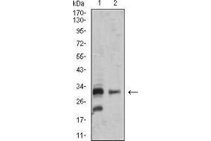 Western blot analysis using TNFSF13B mouse mAb against SK-N-SH (1) and MOLT4 (2) cell lysate. (BAFF antibody  (AA 116-278))
