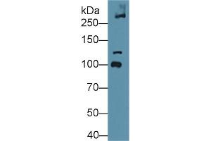 Detection of COL6a3 in Mouse Bladder lysate using Polyclonal Antibody to Collagen Type VI Alpha 3 (COL6a3) (COL6a3 antibody  (AA 2009-2205))