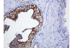 Image no. 1 for anti-Src-like-adaptor 2 (SLA2) antibody (ABIN1500954) (SLAP2 antibody)