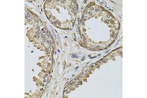 Immunohistochemistry of paraffin-embedded human prostate using CCNA2 antibody.