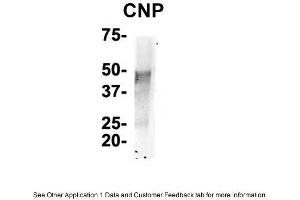 IP Suggested Anti-CNP Antibody    Positive Control:  NT2 CELL/BRAIN TISSUE (Cnpase antibody  (N-Term))