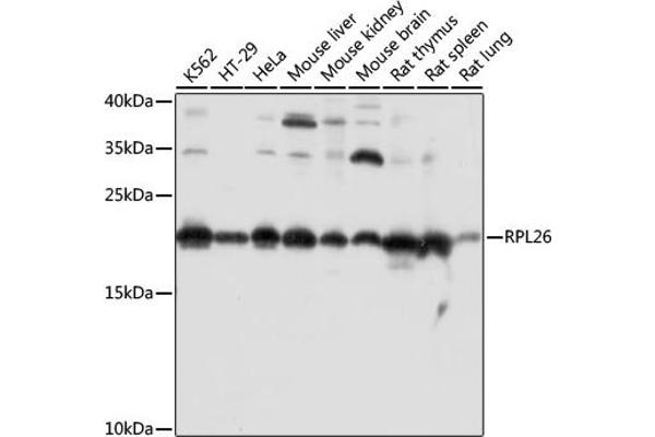 RPL26 Antikörper  (AA 20-95)